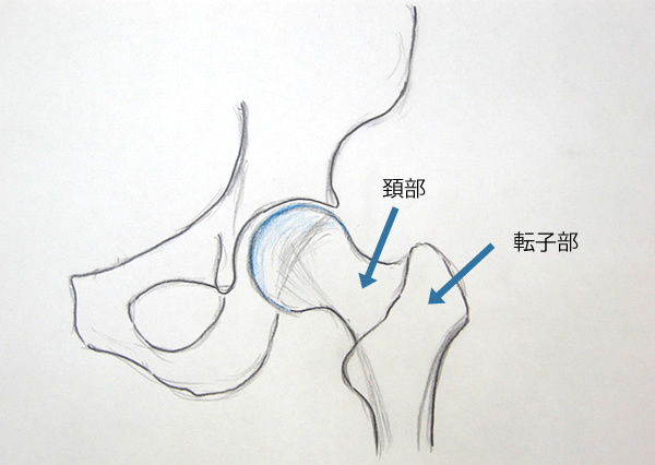 外傷 骨折 医療法人社団研宣会 広瀬病院